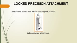 PRECISION ATTACHMENTS and their significance in dentistry.pptx