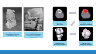 D'Urso et al.,
Biomodeling as an aid to spinal
instrumentation, 2005
Wagner et al.,
Rapid 3-dimensional prototyping for
surgical repair of maxillofacial
fractures, 2004
Image Acquistion
MRI/CT/3DUS
Image Segmentation
and Volumes Computation
Image Segmentation
and Volumes Computation
Image Segmentation
and Volumes Computation
 