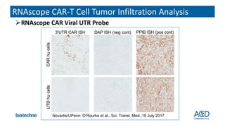 Ubc Rnu6 Rnascope Expanding Precision Medicine & Biomarker Strategy Options with RNAscope ...