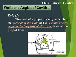 Pulpal Classification Comprehensive Guide to Cavity Classification and Nomenclature in ...