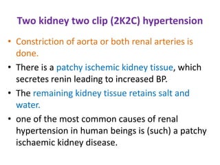 Two kidney two clip (2K2C) hypertension
• Constriction of aorta or both renal arteries is
done.
• There is a patchy ischemic kidney tissue, which
secretes renin leading to increased BP.
• The remaining kidney tissue retains salt and
water.
• one of the most common causes of renal
hypertension in human beings is (such) a patchy
ischaemic kidney disease.
 