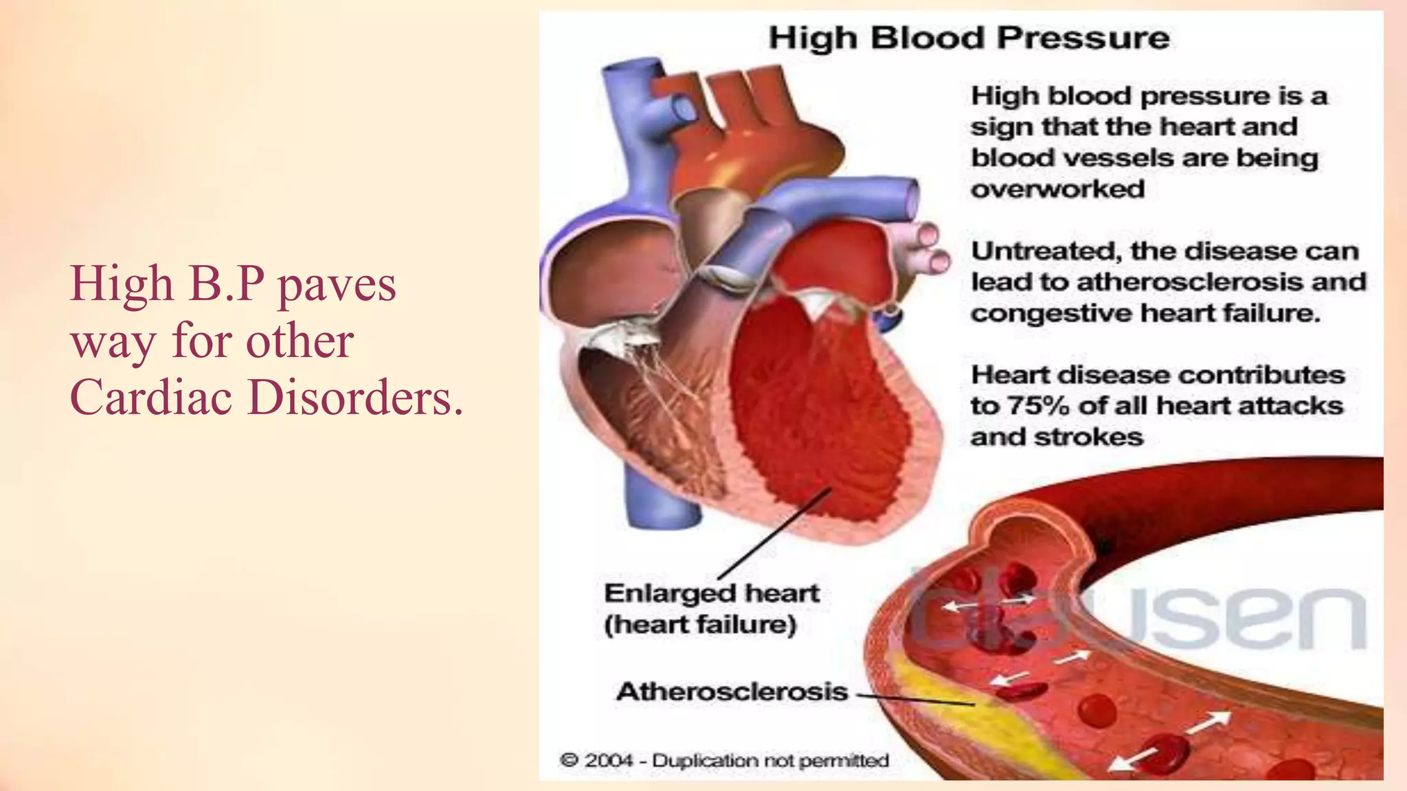 High B.P paves
way for other
Cardiac Disorders.
 