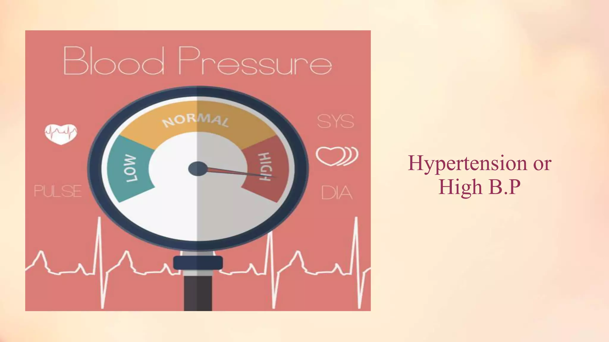 Hypertension or
High B.P
 