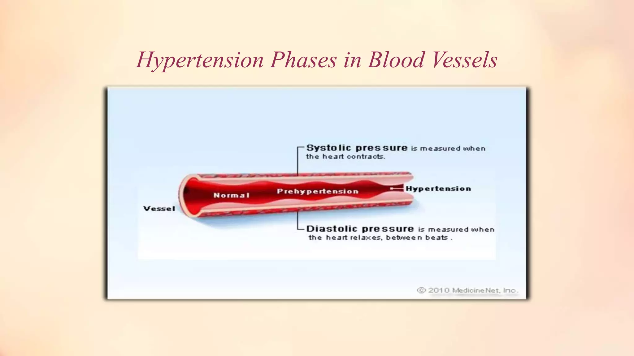 Hypertension Phases in Blood Vessels
 