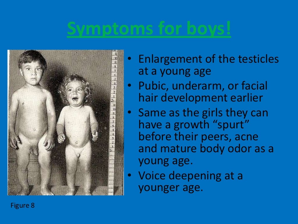precocious-puberty