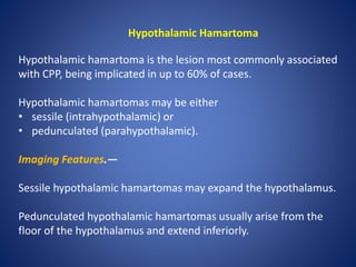 Hypothalamic Hamartoma
Hypothalamic hamartoma is the lesion most commonly associated
with CPP, being implicated in up to 60% of cases.
Hypothalamic hamartomas may be either
• sessile (intrahypothalamic) or
• pedunculated (parahypothalamic).
Imaging Features.—
Sessile hypothalamic hamartomas may expand the hypothalamus.
Pedunculated hypothalamic hamartomas usually arise from the
floor of the hypothalamus and extend inferiorly.
 
