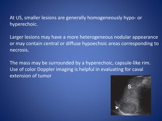 At US, smaller lesions are generally homogeneously hypo- or
hyperechoic.
Larger lesions may have a more heterogeneous nodular appearance
or may contain central or diffuse hypoechoic areas corresponding to
necrosis.
The mass may be surrounded by a hyperechoic, capsule-like rim.
Use of color Doppler imaging is helpful in evaluating for caval
extension of tumor
 