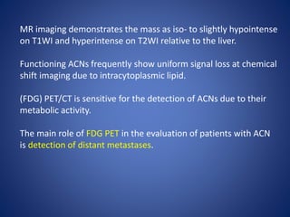 MR imaging demonstrates the mass as iso- to slightly hypointense
on T1WI and hyperintense on T2WI relative to the liver.
Functioning ACNs frequently show uniform signal loss at chemical
shift imaging due to intracytoplasmic lipid.
(FDG) PET/CT is sensitive for the detection of ACNs due to their
metabolic activity.
The main role of FDG PET in the evaluation of patients with ACN
is detection of distant metastases.
 