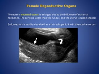 Female Reproductive Organs
The normal neonatal uterus is enlarged due to the influence of maternal
hormones. The cervix is larger than the fundus, and the uterus is spade shaped.
Endometrium is readily visualized as a thin echogenic line in the uterine corpus.
 