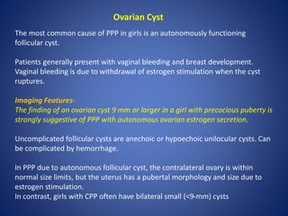 Ovarian Cyst
The most common cause of PPP in girls is an autonomously functioning
follicular cyst.
Patients generally present with vaginal bleeding and breast development.
Vaginal bleeding is due to withdrawal of estrogen stimulation when the cyst
ruptures.
Imaging Features-
The finding of an ovarian cyst 9 mm or larger in a girl with precocious puberty is
strongly suggestive of PPP with autonomous ovarian estrogen secretion.
Uncomplicated follicular cysts are anechoic or hypoechoic unilocular cysts. Can
be complicated by hemorrhage.
In PPP due to autonomous follicular cyst, the contralateral ovary is within
normal size limits, but the uterus has a pubertal morphology and size due to
estrogen stimulation.
In contrast, girls with CPP often have bilateral small (<9-mm) cysts
 