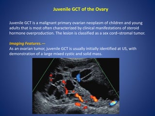 Juvenile GCT of the Ovary
Juvenile GCT is a malignant primary ovarian neoplasm of children and young
adults that is most often characterized by clinical manifestations of steroid
hormone overproduction. The lesion is classified as a sex cord–stromal tumor.
Imaging Features.—
As an ovarian tumor, juvenile GCT is usually initially identified at US, with
demonstration of a large mixed cystic and solid mass.
 