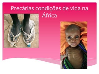 Precárias condições de vida na
            África
 