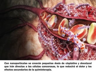 Con nanopartículas se crearán pequeñas dosis de cisplatino y docetaxel 
que irán directas a las células cancerosas, lo que reducirá el dolor y los 
efectos secundarios de la quimioterapia. 
 