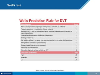 Wells rule
26
Wells et al., Lancet, 1997. doi: 10.1016/S0140-6736(97)08140-3
 