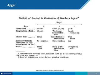 Apgar
27
Apgar, JAMA, 1958. doi: 10.1001/jama.1958.03000150027007
 