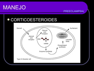 MANEJO CORTICOESTEROIDES PREECLAMPSIA 