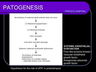 PATOGENESIS PREECLAMPSIA SYSTEMIC ENDOTHELIAL  DYSFUNCTION  Fms–like tyrosine kinase-1 Vascular endothelial  growth factor  Antagonizes placental  growth factor  Hypothesis for the role of sFlt1 in preeclampsia  