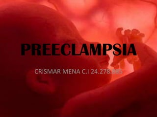 PREECLAMPSIA
CRISMAR MENA C.I 24.278.885
 
