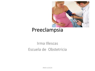 Preeclampsia
Irma Illescas
Escuela de Obstetricia
IRMA ILLESCAS
 