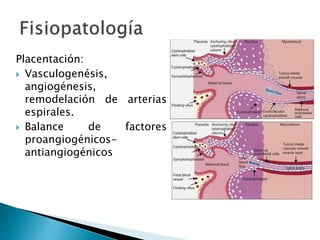 Placentación:
 Vasculogenésis,
angiogénesis,
remodelación de arterias
espirales.
 Balance de factores
proangiogénicos-
antiangiogénicos
 