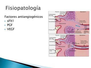 Factores antiangiogénicos
 sFlt1
 PGF
 VEGF
 