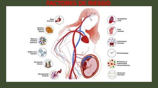 FACTORES DE RIESGO
 