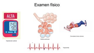 Examen físico
Taquicardia
Convulsion tonico clonica
Edema pulmonar
Hipertensión arterial
 