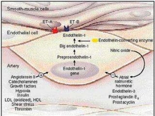 PREECLAMPSIAETIOPATOGENIARIÑÓN:Endoteliosis capilar glomerular