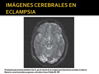 Preeclampsia guía perinatal colombiana. Guía 14, guia de atención de las complicaciones hipertensivas asociadas al embarazo
Obstetrics, normal and problem pregnancies, sixth edition. Steven G Gabbe MD. 2012

 