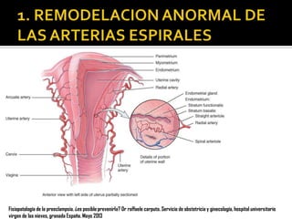 Fisiopatología de la preeclampsia. ¿es posible prevenirla? Dr raffaele carputo. Servicio de obstetricia y ginecología, hospital universitario
virgen de las nieves, granada España. Mayo 2013

 