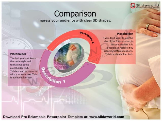 Pre Eclampsia Powerpoint Template - SlideWorld | PPTX