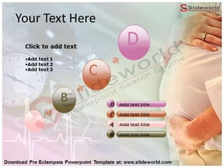 Pre Eclampsia Powerpoint Template - SlideWorld | PPTX