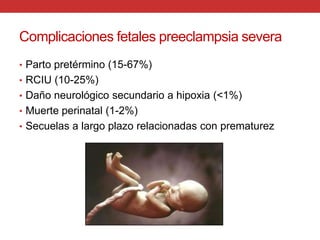Edema que afecta solo extremidades