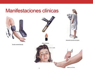 Manifestaciones clínicas