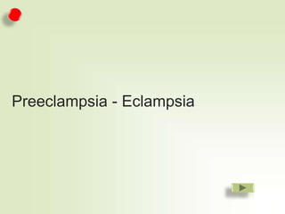 Preeclampsia - Eclampsia

 