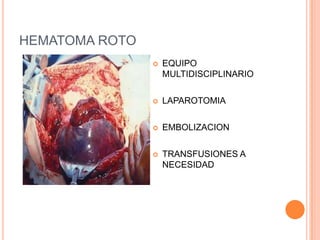 HEMATOMA ROTO
                   EQUIPO
                    MULTIDISCIPLINARIO

                   LAPAROTOMIA

                   EMBOLIZACION

                   TRANSFUSIONES A
                    NECESIDAD
 