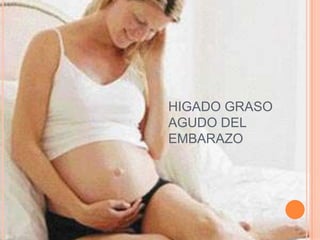 HIGADO GRASO
AGUDO DEL
EMBARAZO
 