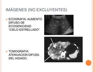 IMÁGENES (NO EXCLUYENTES)

   ECOGRAFIA: AUMENTO
    DIFUSO DE
    ECOGENICIDAD
    “CIELO ESTRELLADO”




   TOMOGRAFIA:
    ATENUACION DIFUSA
    DEL HIGADO.
 