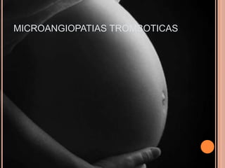 MICROANGIOPATIAS TROMBOTICAS
 