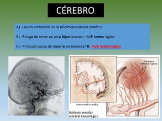 CÉREBRO:
A) Lesión endotelial de la microvasculatura cerebral
B) Riesgo de tener un pico hipertensivo = AVE hemorrágico
C) Principal causa de muerte en toxemia? R: AVE hemorrágico
 