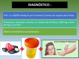 DIAGNÓSTICO :
HTA: ≥ a 140/90 mmHg en por lo menos 2 tomas con espacio de 6 horas.
Proteinuria: Excreción urinaria, en muestra de 24 horas ≥ 300 mg; o bien
30 mg (+) en tira*.
Edema inconstante en preeclampsia
+ +
 