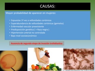 CAUSAS:
Mayor probabilidad de aparecer en mujeres:
• Expuestas 1ª vez a vellosidades coriónicas
• Superabundancia de vellosidades coriónicas (gemelos)
• Enfermedad vascular preexistente
• Predisposición genética ( + Raza negra )
• Hipertensión arterial no controlada
• Bajo nivel socioeconómico
Ausencia de segunda etapa de invasión trofoblastica
 