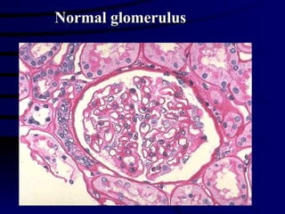 Normal glomerulus 
