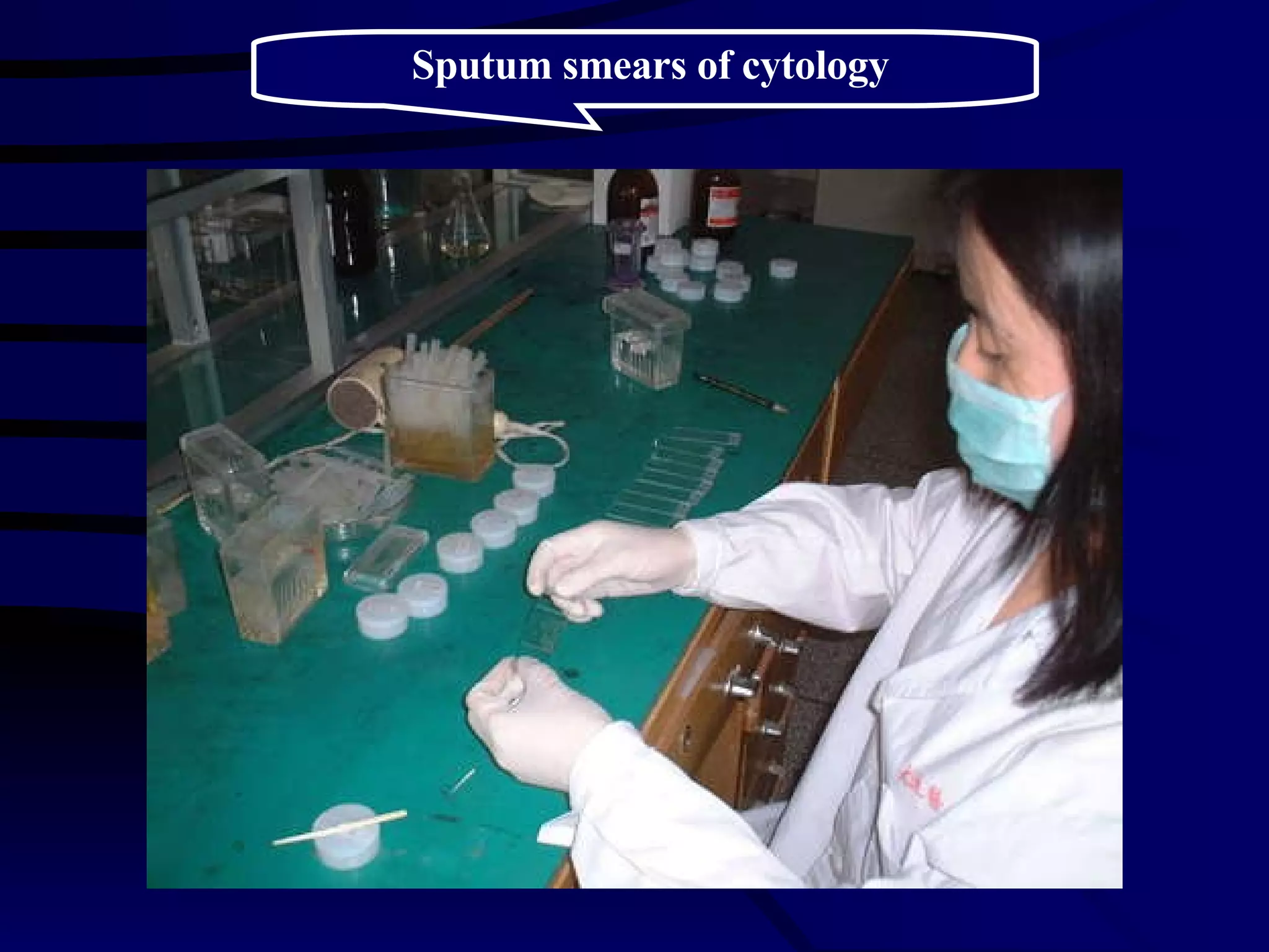Sputum smears of  cytology 