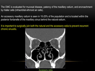 Accessory Ostium Pre fess pns ct | PPTX