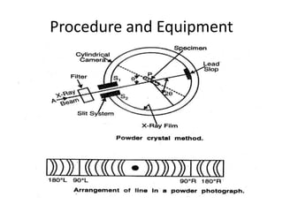 Procedure and Equipment 
 