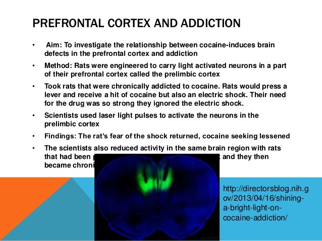 prefrontal cortex
