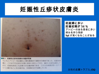 妊娠中のお肌のトラブルレクチャー Dermatology In Pregnancy