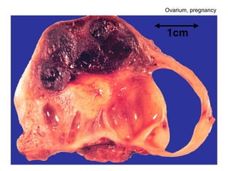 Ovarium, pregnancy