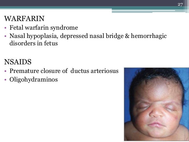 warfarin overdose antidote warfarin overdose antidote